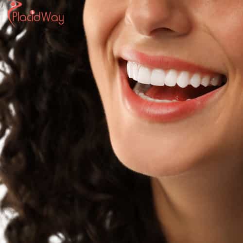 All-on-4 Full Arch Implants Abroad for Complete Smile Transformation and Faster Recovery